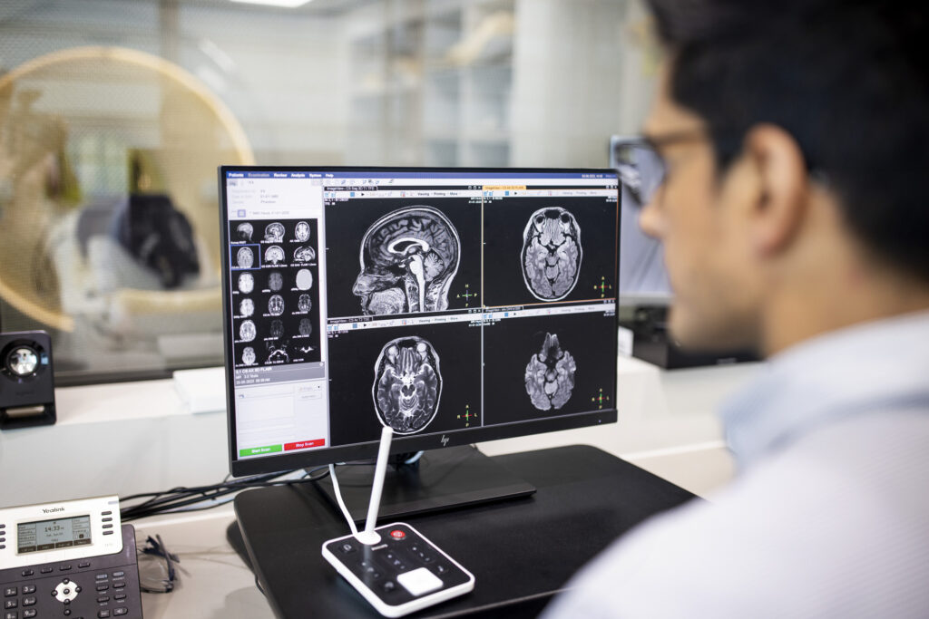Brain MRI at Imaging Associates Carlton
